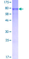 12.5% SDS-PAGE Stained with Coomassie Blue